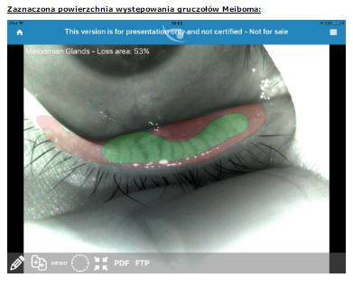 Aparaty do badania filmu łzowego (zespół suchego oka) B/D Analizator gruczołów Meiboma