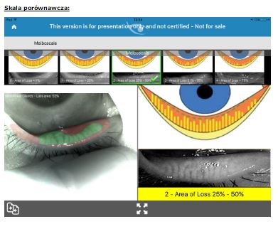 Aparaty do badania filmu łzowego (zespół suchego oka) B/D Analizator gruczołów Meiboma