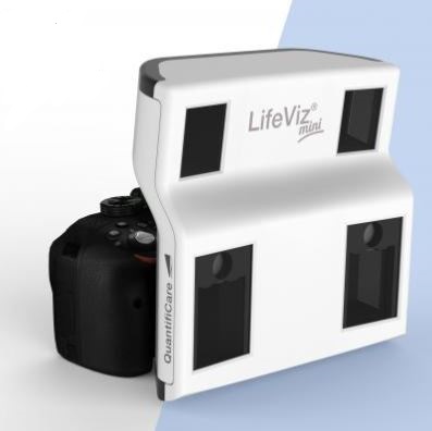 Aparaty do badania skóry (twarzy) i obrazowania 3D QuantifiCare 3D LifeViz Mini