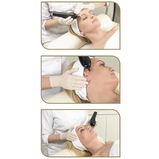 Aparaty do beziwazyjnego liftingu powiek Neauvia Devices Plasma IQ