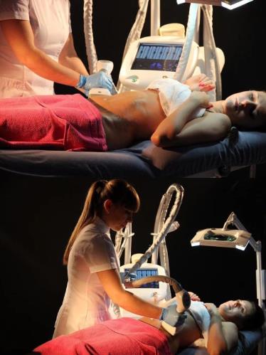 Aparaty do redukcji cellulitu i modelowania sylwetki B/D Celushape RF