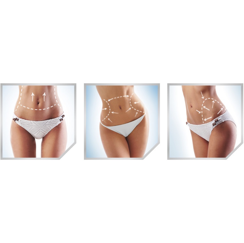 Aparaty do redukcji cellulitu i modelowania sylwetki Jeisys LIPOcel