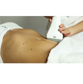 Aparaty do redukcji cellulitu i modelowania sylwetki LestheZone LipoRadioLogie VIBRO