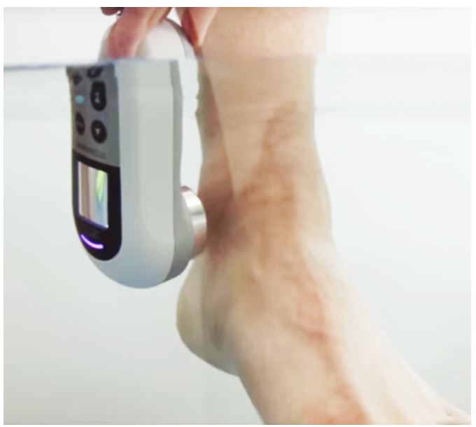 Aparaty do terapii ultradźwiękowej w rehabilitacji ITO Physiotherapy & Rehabilitation US-101L / US-103S