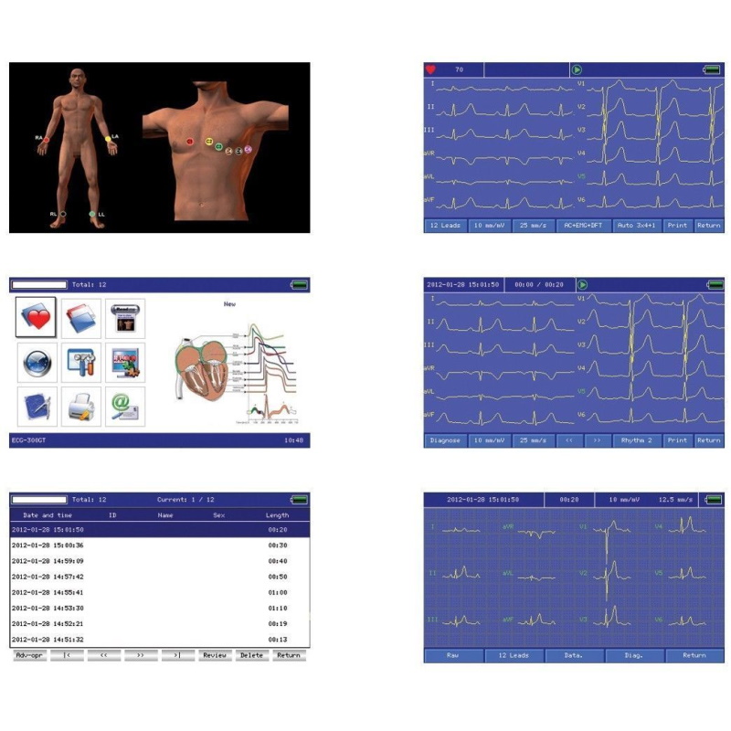 Aparaty EKG - Elektrokardiografy CONTEC CMS 300G