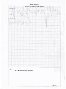 Aparaty EKG - Elektrokardiografy CONTEC PM10