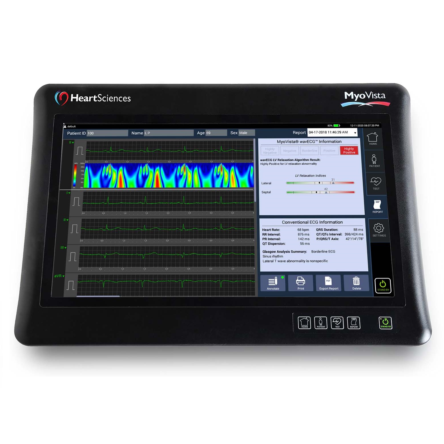 Aparaty EKG - Elektrokardiografy HeartSciences Myovista