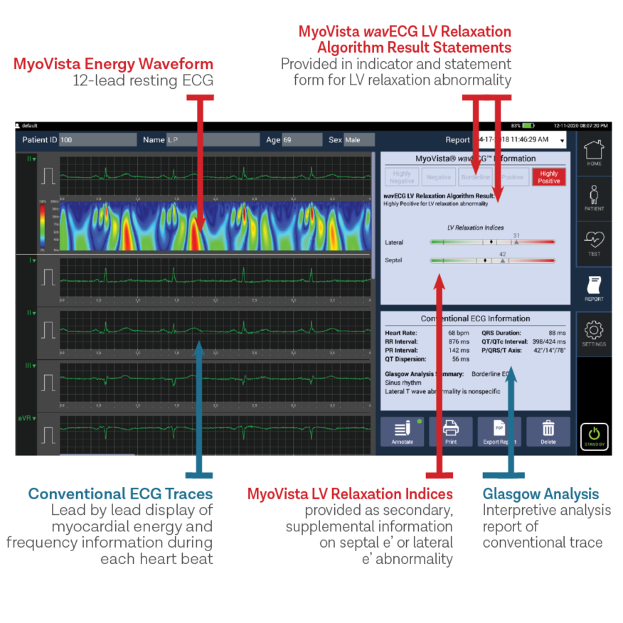 Aparaty EKG - Elektrokardiografy HeartSciences Myovista