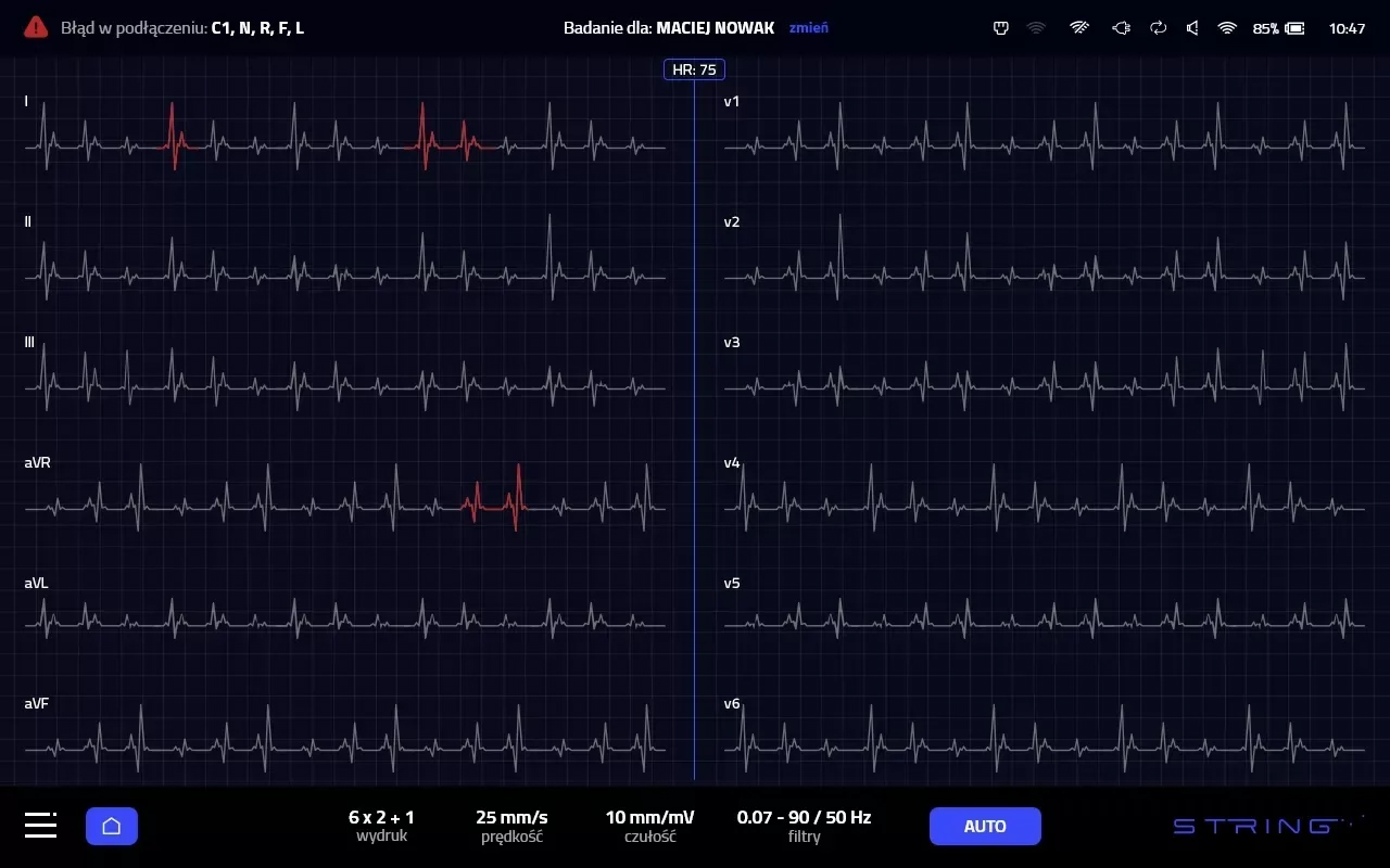 Aparaty EKG - Elektrokardiografy STRING Opus 1