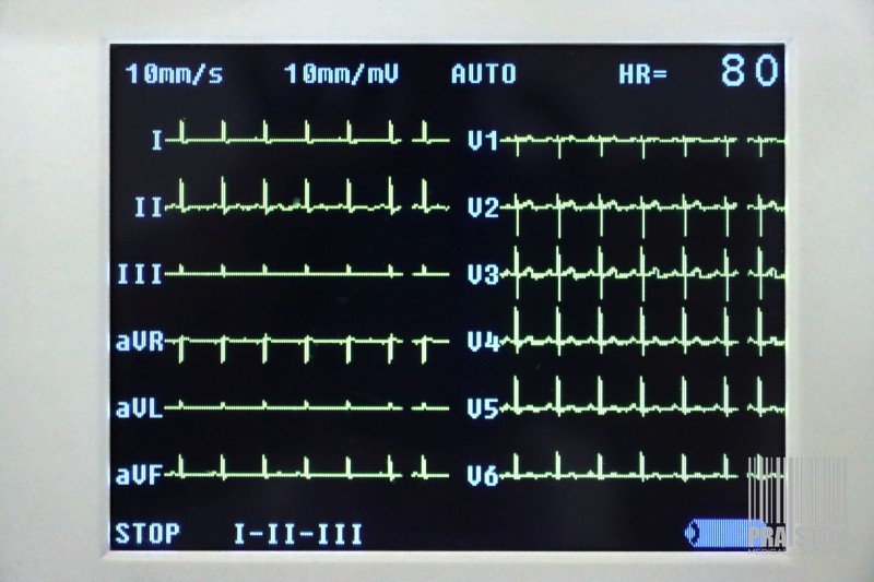 Aparaty EKG - Elektrokardiografy używane B/D m4medical M-Trace - Praiston rekondycjonowany