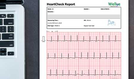 Aparaty EKG - Elektrokardiografy VIATOM Checkme Plus