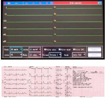 Aparaty EKG weterynaryjne CONTEC ECG 600G VET