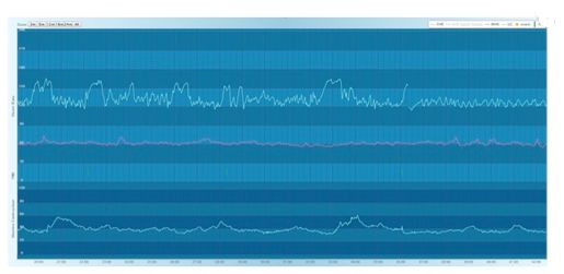 Aparaty KTG - kardiotokografy B/D Sense 4 Baby