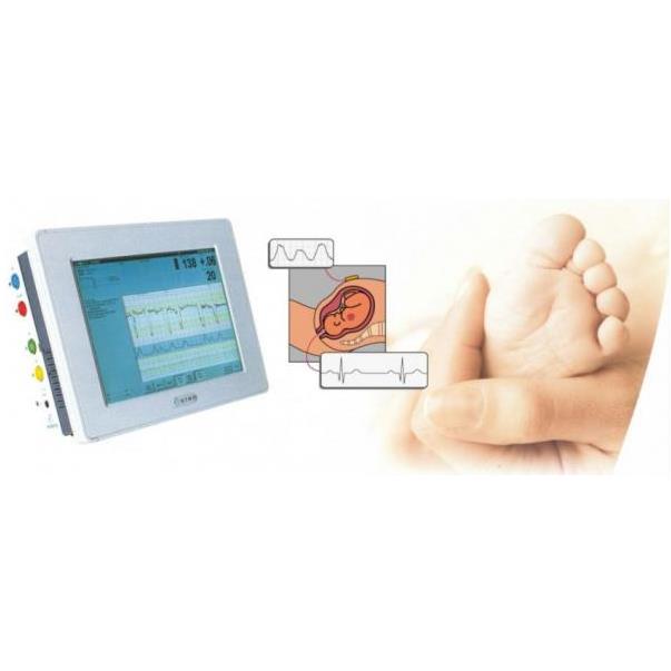 Aparaty KTG - kardiotokografy Neoventa STAN S31