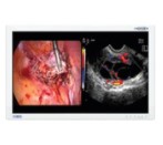 Artroskopy - optyki artroskopowe B/D zestaw