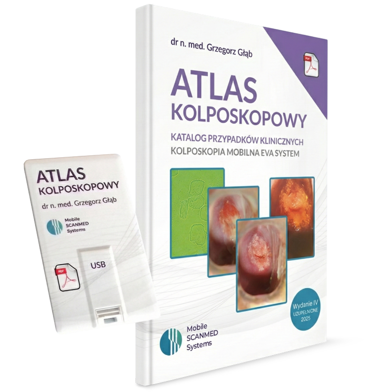 Atlasy kolposkopowe Mobile Scanmed Systems Atlas kolposkopowy katalog przypadków medycznych