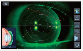 Autorefraktometry (autokeratorefraktometry) HUVITZ HRK-9000A