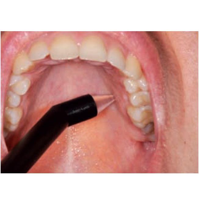 Biometry tkanek miękkich przyzębia ECHO-SON PIROP G