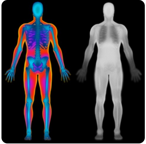 Densytometry rentgenowskie HOLOGIC Horizon