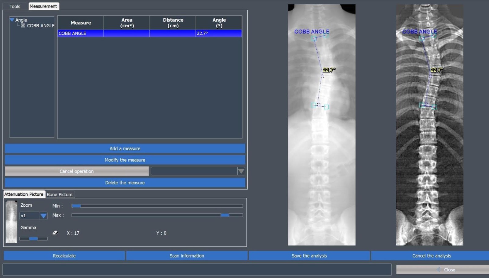 Densytometry rentgenowskie Medix MEDIX DR