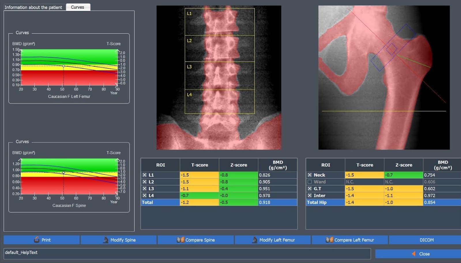 Densytometry rentgenowskie Medix MEDIX DR