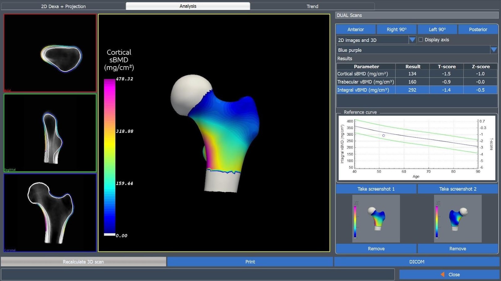 Densytometry rentgenowskie Medix MEDIX DR