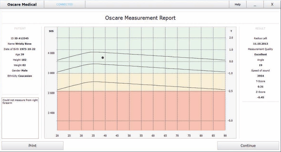 Densytometry ultradźwiękowe Oscare Medical OsCare Sono