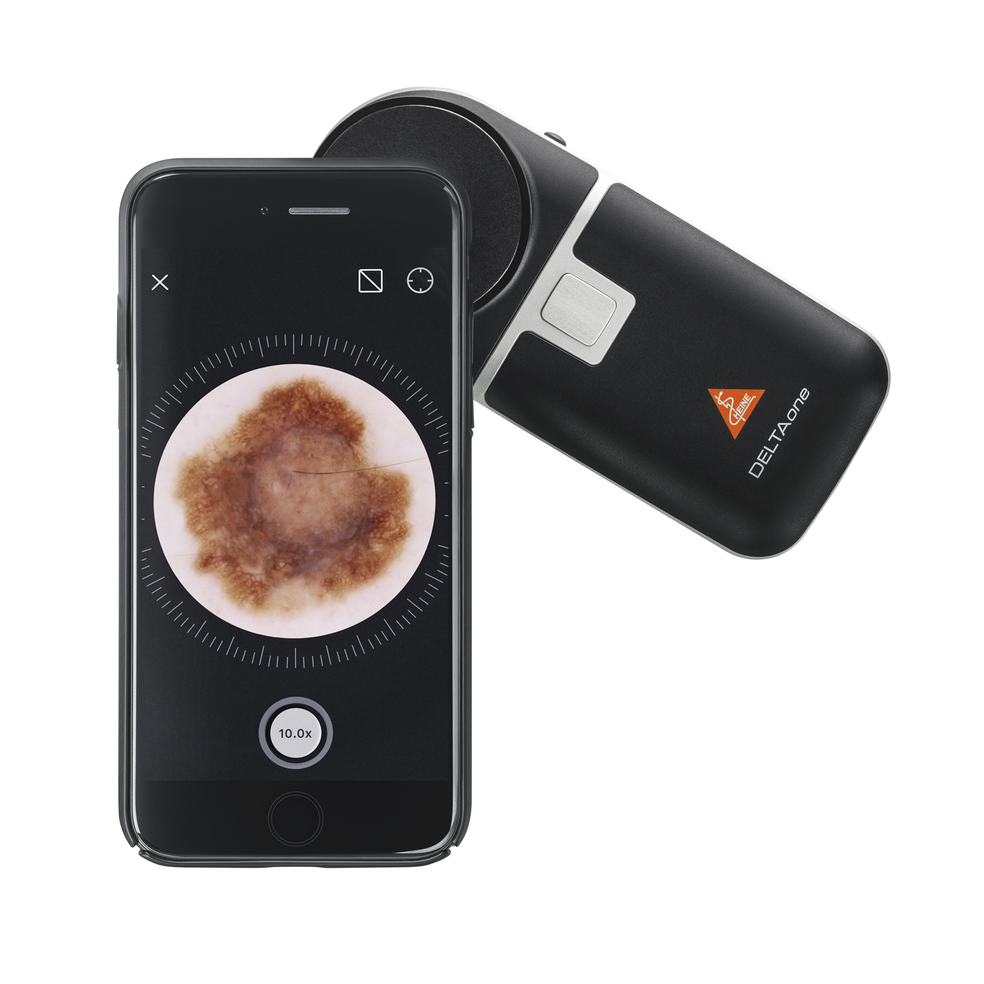 Dermatoskopy ręczne Heine DELTAone