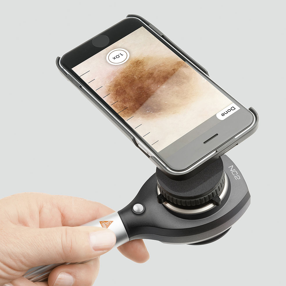 Dermatoskopy ręczne Heine NC2