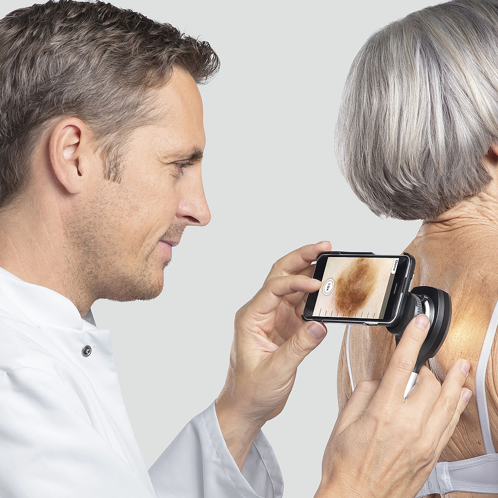 Dermatoskopy ręczne Heine NC2