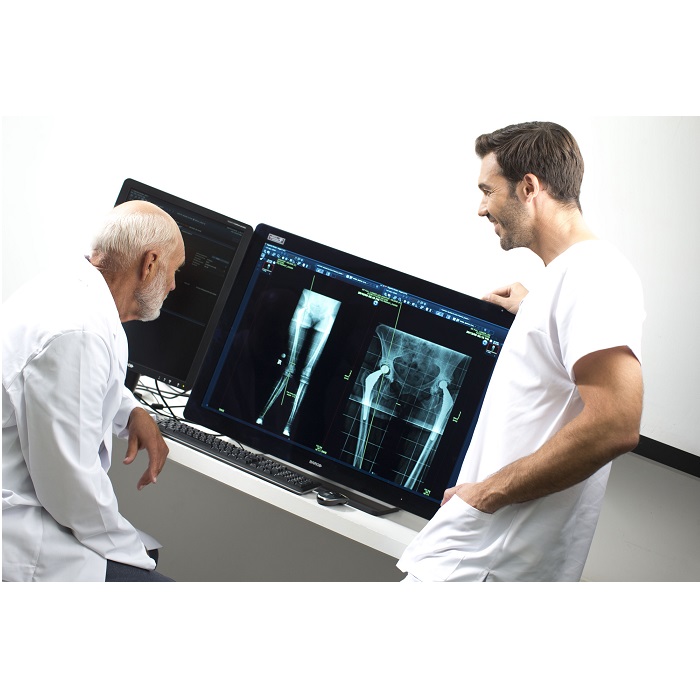 Diagnostyka obrazowa - oprogramowanie AGFA Healthcare Enterprise Imaging Radiology