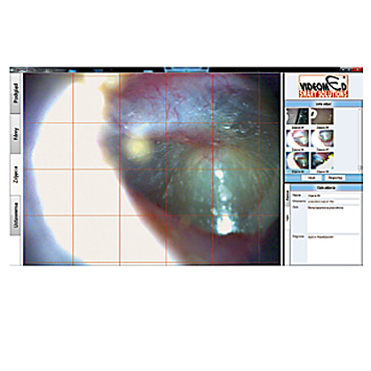 Diagnostyka obrazowa - oprogramowanie B/D Effetha Video