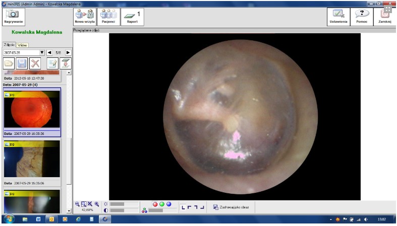 Diagnostyka obrazowa - oprogramowanie B/D IRIS