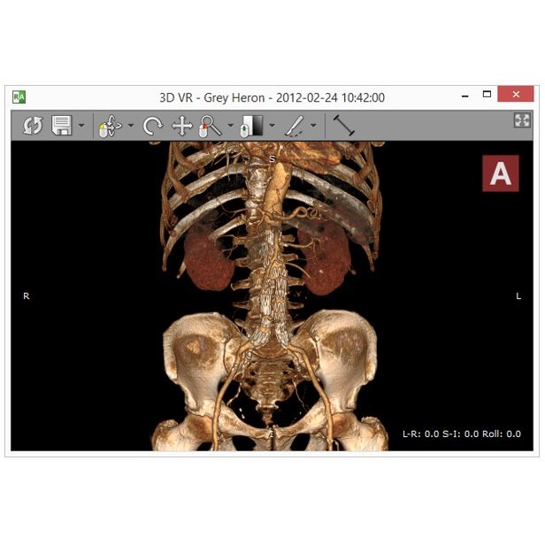 Diagnostyka obrazowa - oprogramowanie RadiAnt RadiAnt DICOM VIEWER