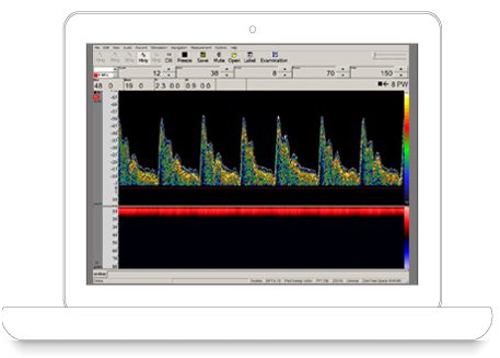Dopplery naczyń czaszkowych i szyjnych DWL Doppler Box