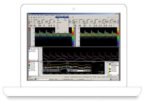 Dopplery naczyń czaszkowych i szyjnych DWL Doppler Box