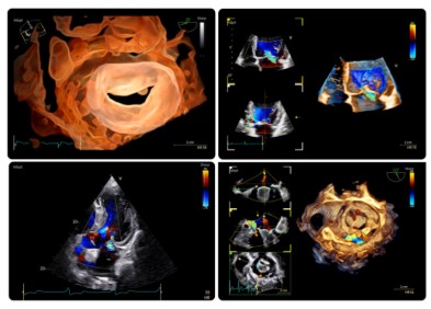 Echokardiografy - UKG GE Healthcare Vivid Pioneer