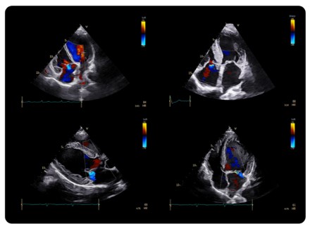 Echokardiografy - UKG GE Healthcare Vivid Pioneer