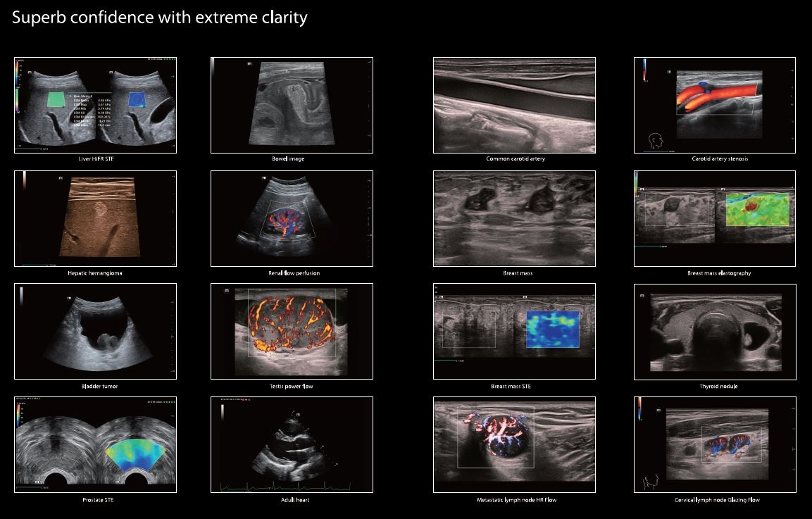 Echokardiografy - UKG MINDRAY Resona I9