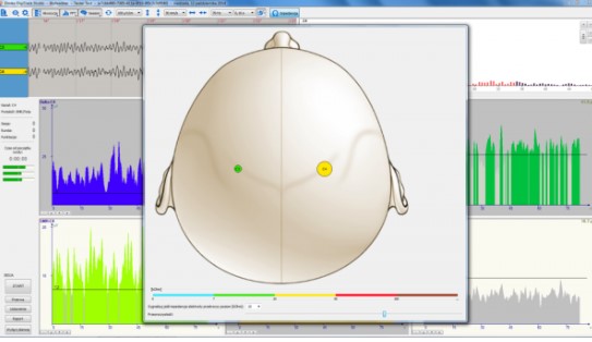 EEG Biofeedback (neurofeedback) Koordynacja Zestaw nr 4 EEG Biofeedback 5 kanałowy – Kompleksowe wyposażenie