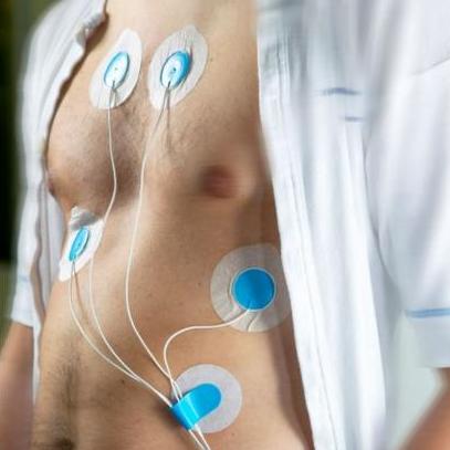 Elektrody EKG jednorazowe Ambu EKG Blue Sensor VL