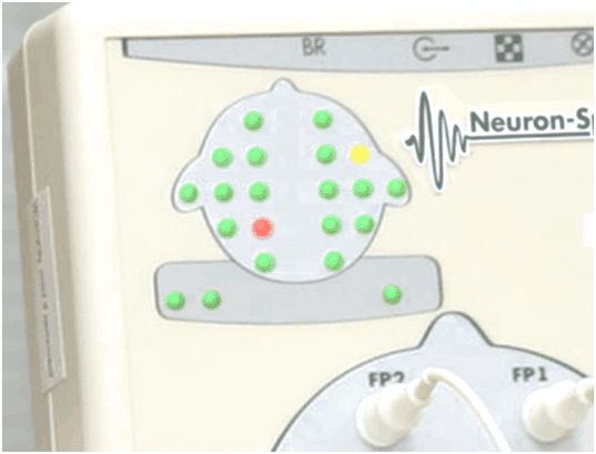 Elektroencefalografy (EEG) Neurosoft Neuron Spectrum 3