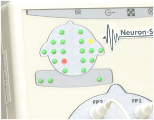 Elektroencefalografy (EEG) Neurosoft Neuron Spectrum 4/P