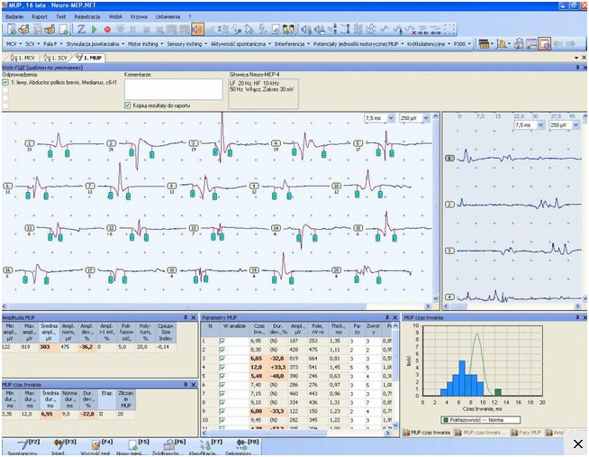 Elektromiografy (EMG) Neurosoft Neuro-Mep-4