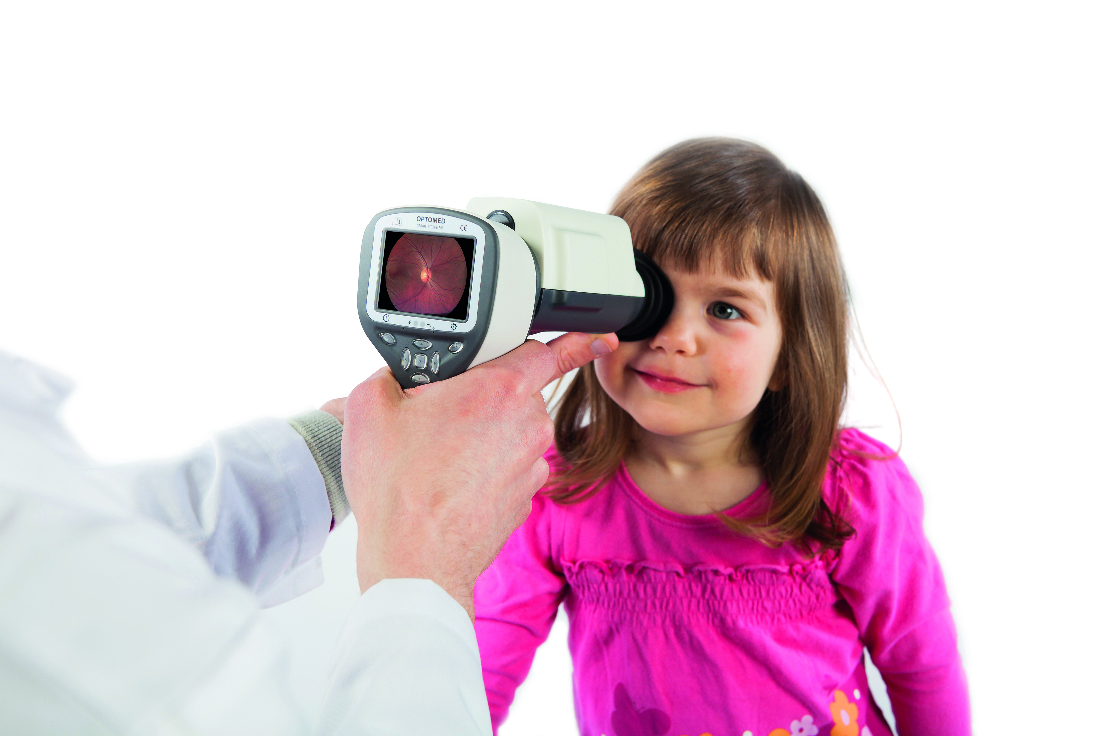 Funduskamery Optomed Smartscope PRO