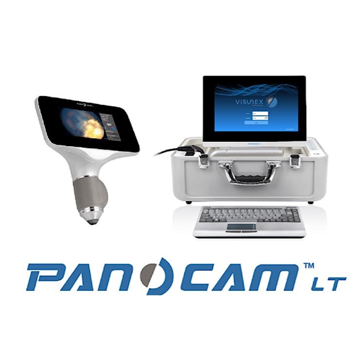 Funduskamery Visunex PanoCam LT