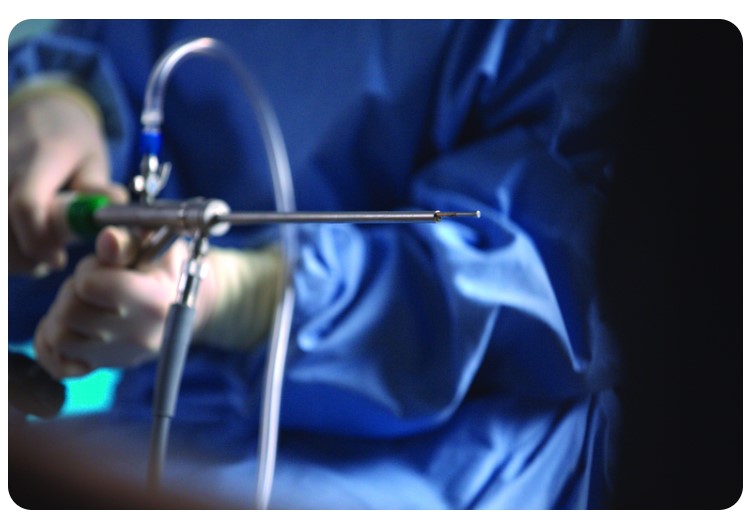 Histeroskopy HOLOGIC MyoSure