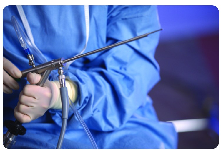 Histeroskopy HOLOGIC MyoSure