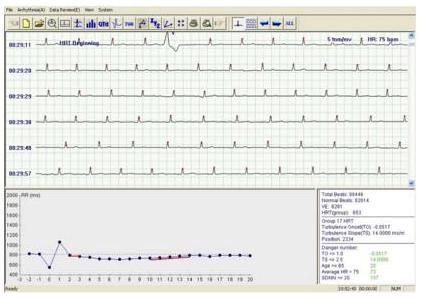 Holtery EKG – rejestratory CONTEC TLC5000