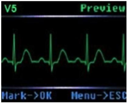 Holtery EKG – rejestratory CONTEC TLC5000